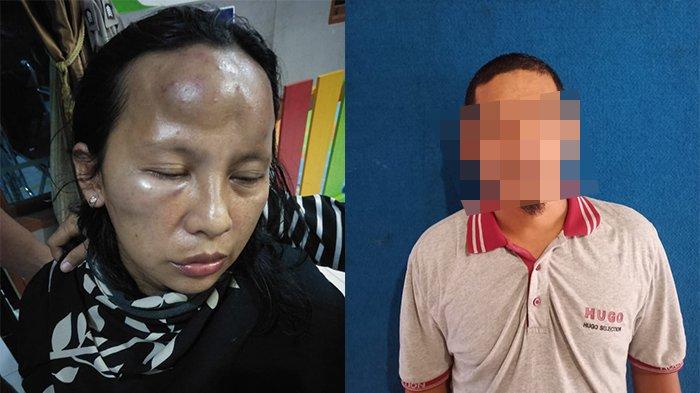 Emosi karena Perkataan, Pria di Pontianak Aniaya Istri Hingga Babak Belur